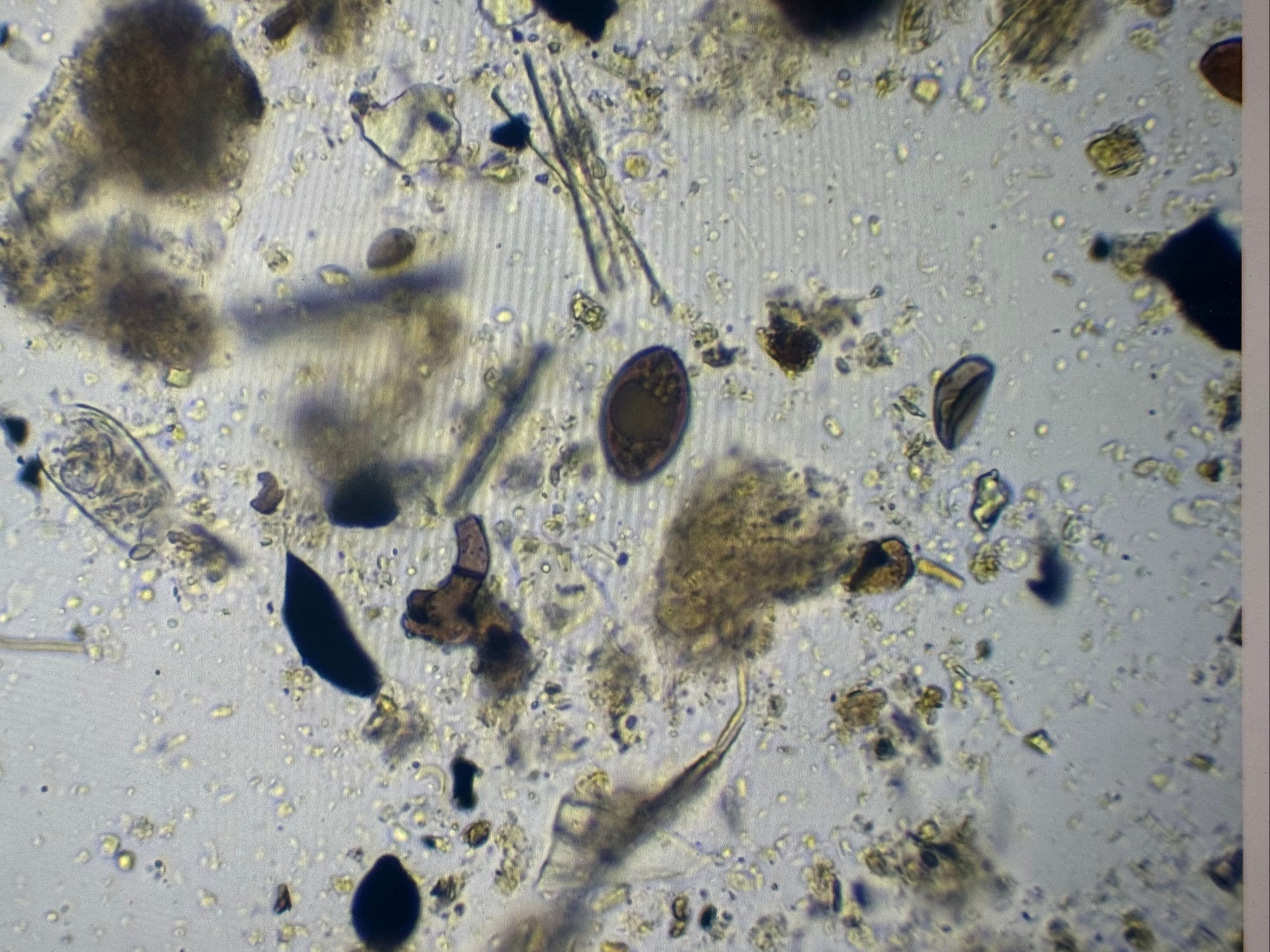 Microscopic view of GROZOME sample containing various organics, humics, micronized biochar, fungal spores, amebae, protozoa and nematodes.  