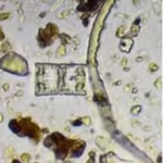 Microbe Extract Bag-Large (10"x5", 600um)